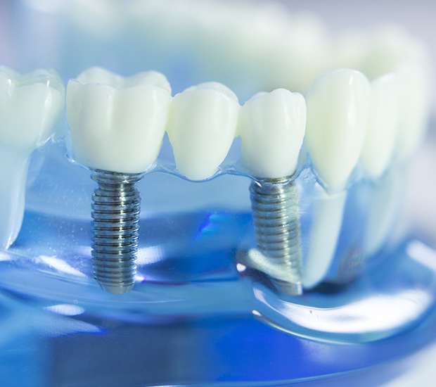Kendall Dental Prosthetics