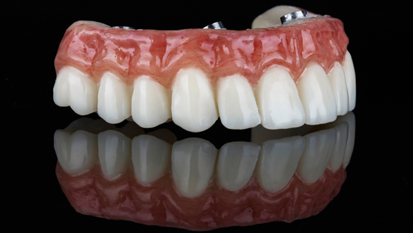 Methods For Caring For Implant Supported Dentures