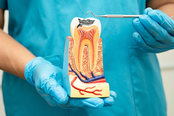 Can Root Canal Treatment Save Teeth?