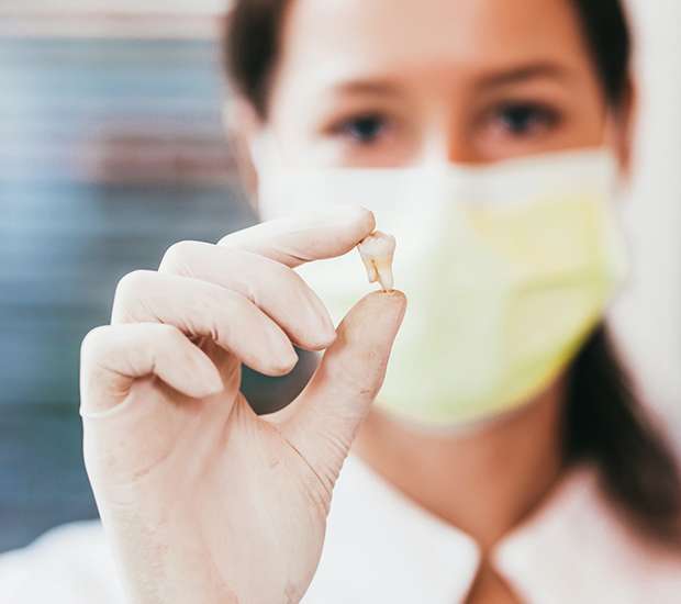 Kendall Tooth Extraction